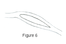 Fig 3. Flow Over a Wing